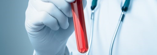 בדיקת Hepatitis A IgG & IgM Antibodies - תמונה